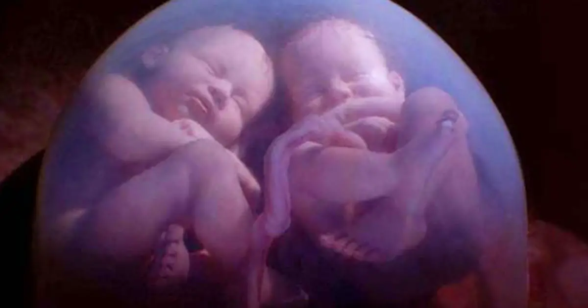 twin-babies-caught-on-mri-scan-fighting-in-their-mothers-womb